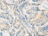SYNGR1 Polyclonal Antibody Reactivity Human