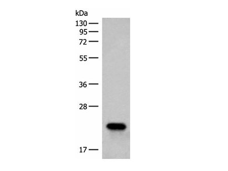RAC3 Polyclonal Antibody Reactivity Human