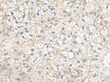 POFUT1 Polyclonal Antibody Reactivity Human