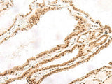 TOR1A Polyclonal Antibody Reactivity Human