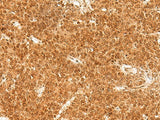 TOR1A Polyclonal Antibody Reactivity Human