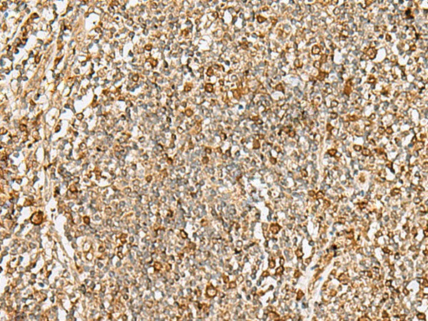 DTYMK Polyclonal Antibody Reactivity Human