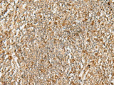 DTYMK Polyclonal Antibody Reactivity Human