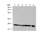 DTYMK Polyclonal Antibody Reactivity Human