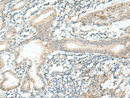 NXNL1 Polyclonal Antibody