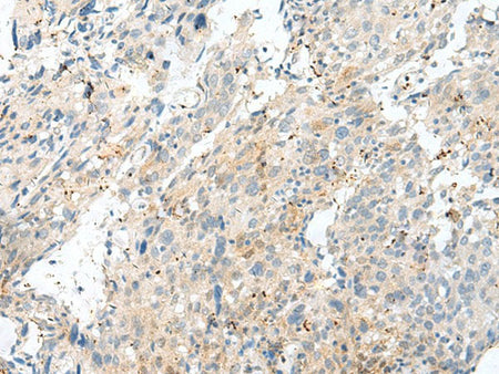 NXNL1 Polyclonal Antibody