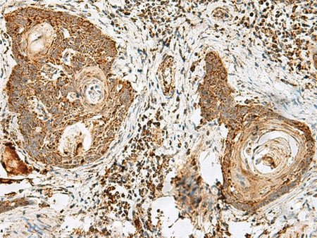 CD48 Polyclonal Antibody Reactivity Human