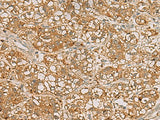 QDPR Polyclonal Antibody Reactivity Human