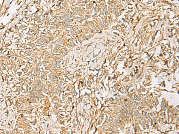 QDPR Polyclonal Antibody Reactivity Human