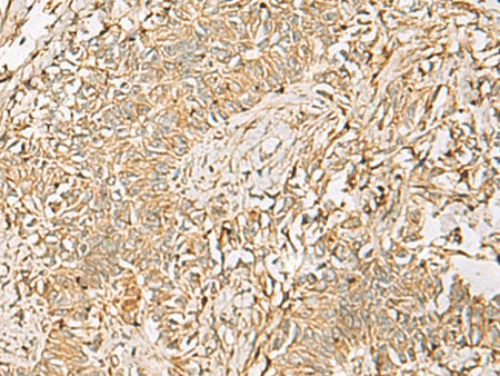 QDPR Polyclonal Antibody Reactivity Human