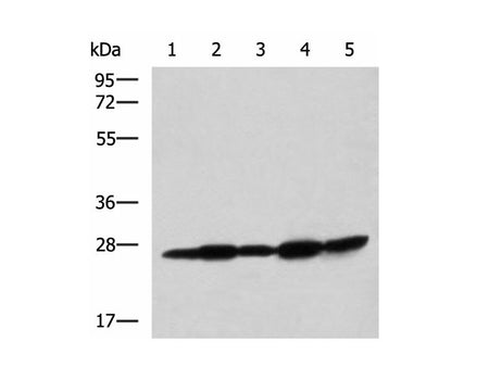 QDPR Polyclonal Antibody Reactivity Human