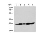 QDPR Polyclonal Antibody Reactivity Human