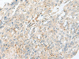 TPMT Polyclonal Antibody Reactivity Human