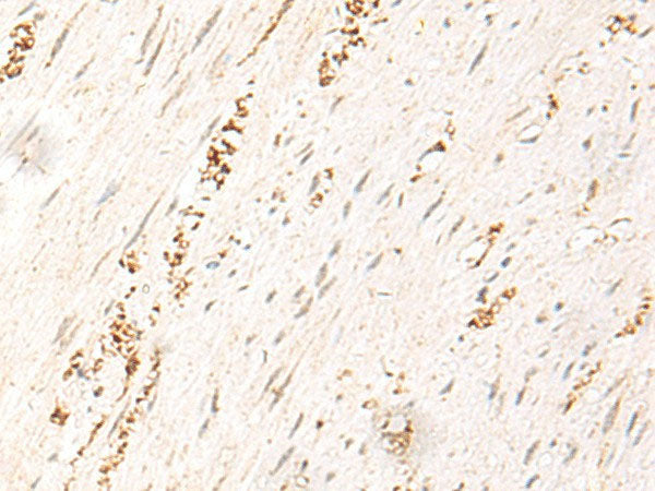 MDFI Polyclonal Antibody Reactivity Human