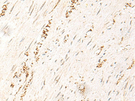 MDFI Polyclonal Antibody Reactivity Human