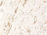MDFI Polyclonal Antibody Reactivity Human