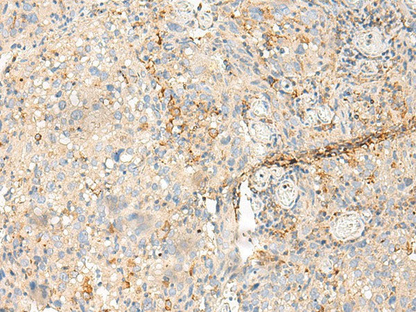 MDFI Polyclonal Antibody Reactivity Human