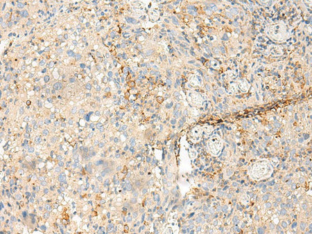 MDFI Polyclonal Antibody Reactivity Human