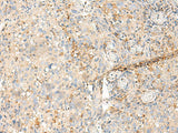 MDFI Polyclonal Antibody Reactivity Human