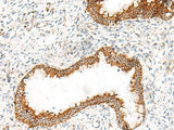 ORC4 Polyclonal Antibody Reactivity Human