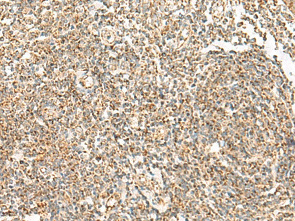 ORC4 Polyclonal Antibody Reactivity Human