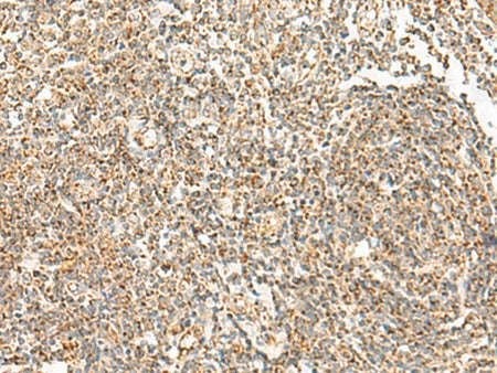 ORC4 Polyclonal Antibody Reactivity Human