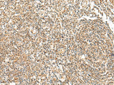 ORC4 Polyclonal Antibody Reactivity Human