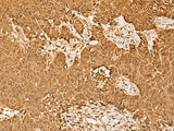PSMA3 Polyclonal Antibody Reactivity Human