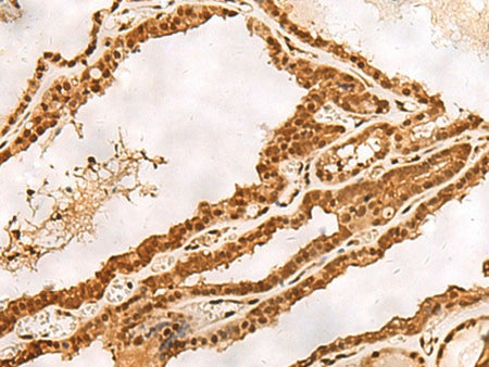 PSMA3 Polyclonal Antibody Reactivity Human