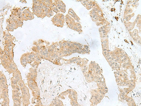 PSMA4 Polyclonal Antibody Reactivity Human