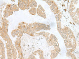 PSMA4 Polyclonal Antibody Reactivity Human