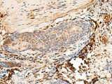 HLA-DQB1 Polyclonal Antibody Reactivity Human