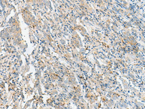 CTRB1 Polyclonal Antibody Reactivity Human