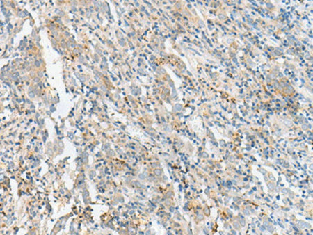 CTRB1 Polyclonal Antibody Reactivity Human