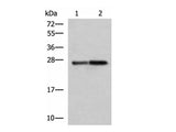 CTRB1 Polyclonal Antibody Reactivity Human