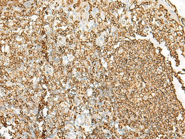 HLA-DRB1 Polyclonal Antibody Reactivity Human