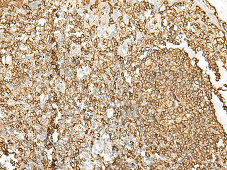 HLA-DRB1 Polyclonal Antibody Reactivity Human