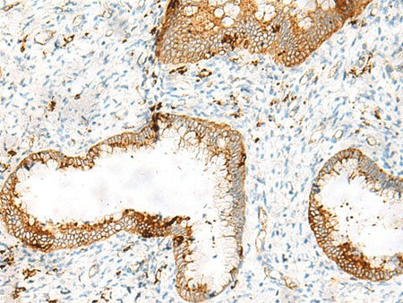 HLA-DRB1 Polyclonal Antibody Reactivity Human