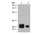 HLA-DRB1 Polyclonal Antibody Reactivity Human