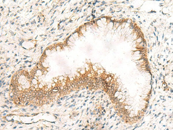 ZNF397 Polyclonal Antibody Reactivity Human