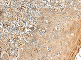 ZNF397 Polyclonal Antibody Reactivity Human