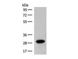 SCGN Polyclonal Antibody Reactivity Human