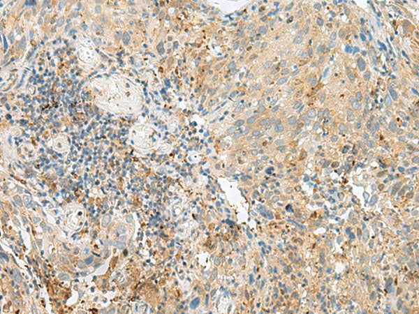 CNPY3 Polyclonal Antibody Reactivity Human
