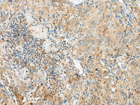 CNPY3 Polyclonal Antibody Reactivity Human