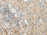CNPY3 Polyclonal Antibody Reactivity Human