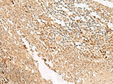 HUS1 Polyclonal Antibody Reactivity Human
