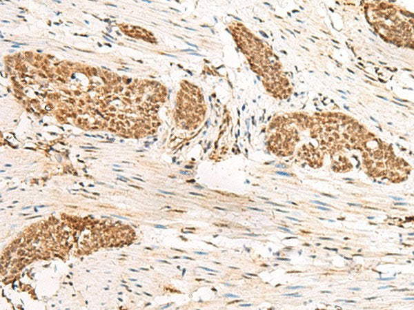 HUS1 Polyclonal Antibody Reactivity Human