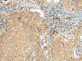 COPE Polyclonal Antibody