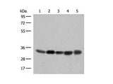 COPE Polyclonal Antibody