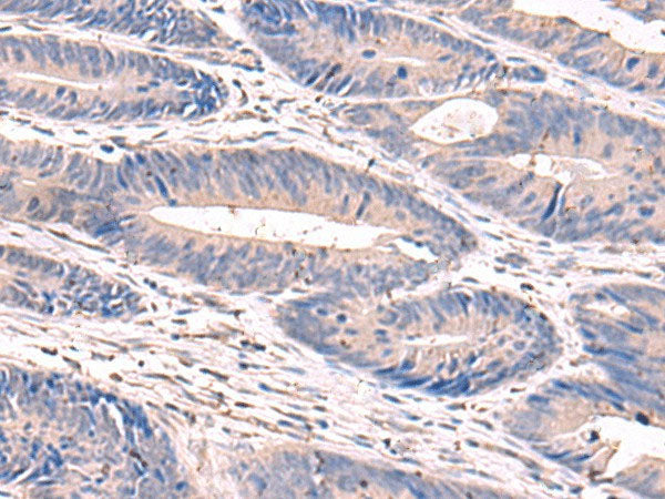 GKAP1 Polyclonal Antibody Reactivity Human